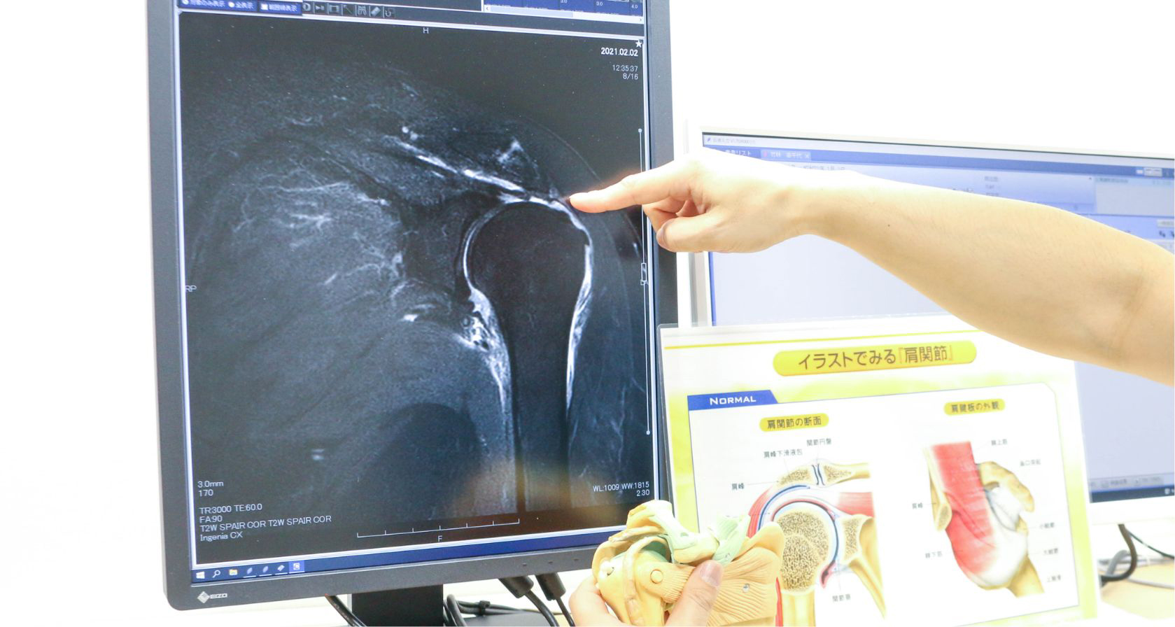 専門の肩や肘の関節鏡視下手術を回生病院（提携医療機関）で実施